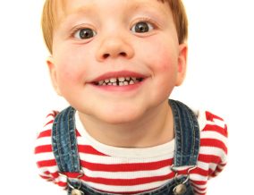 Talking about loose teeth