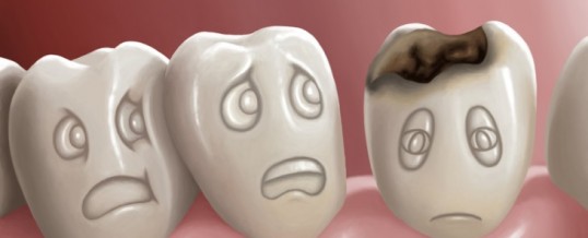 About adult dental anxiety